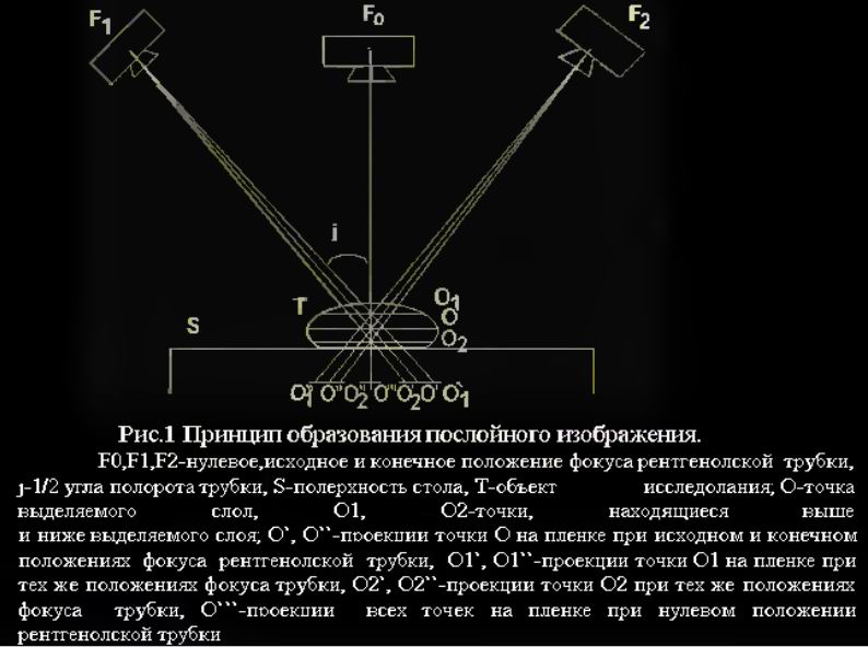 Исходный и конечный. Фокус рентгеновской трубки. Фокус трубки компьютерного томографа. Размер оптического фокуса рентгеновской трубки зависит от. Действительный и оптический фокус рентгеновской трубки.