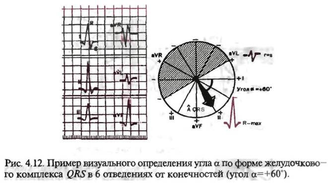 Угол альфа. Вертикальная ЭОС угол Альфа. Угол Альфа QRS. Угол Альфа визуально. Переднезадняя ось сердца.